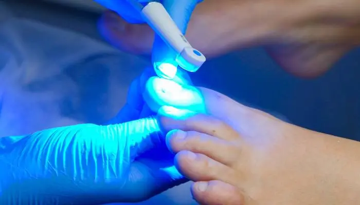 Servicio de Cuidado y Tratamiento para Uñas de Pies